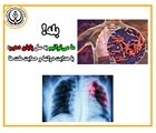 تعهد در مسیر پایان سل